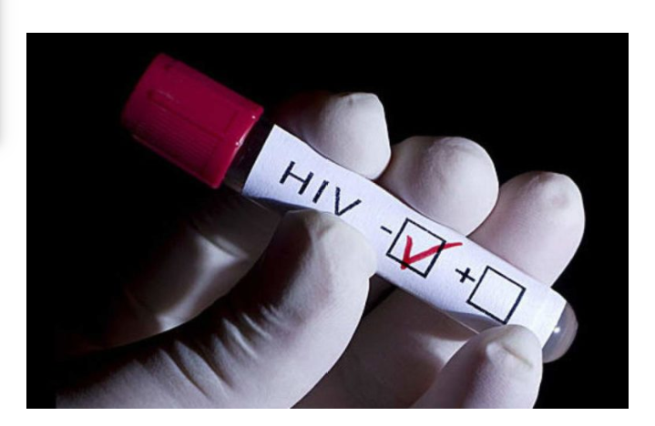 Confirman segundo paciente en el mundo que se cura de VIH