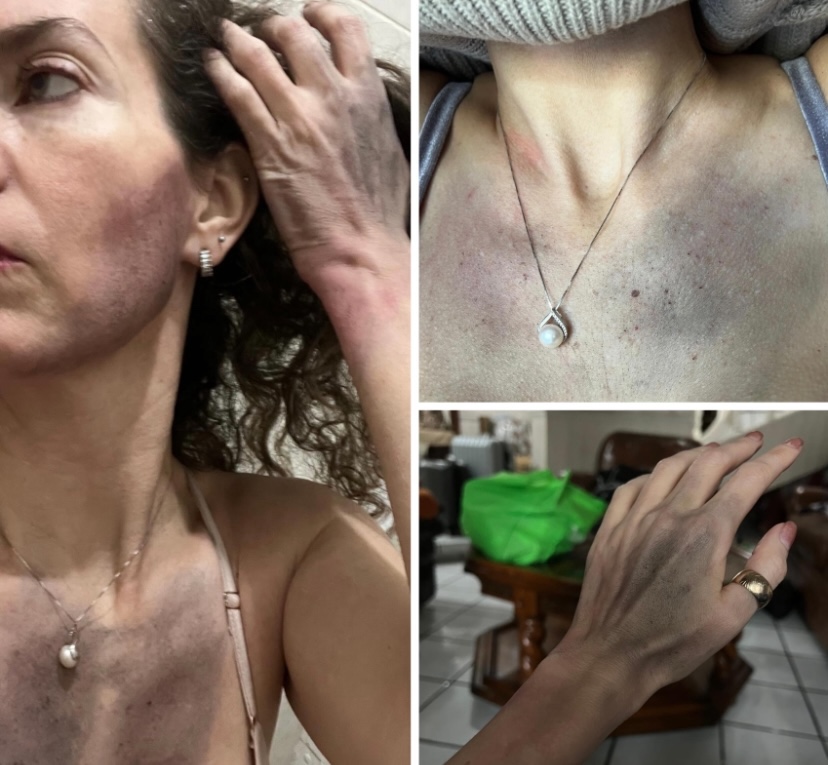 Modelo Mexico-Americana denuncia golpiza por parte de su pareja